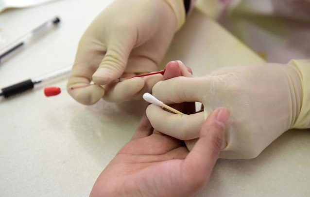 1)手指采血的优点 末梢血可以从手指,耳垂等部位采血,具有操作简便