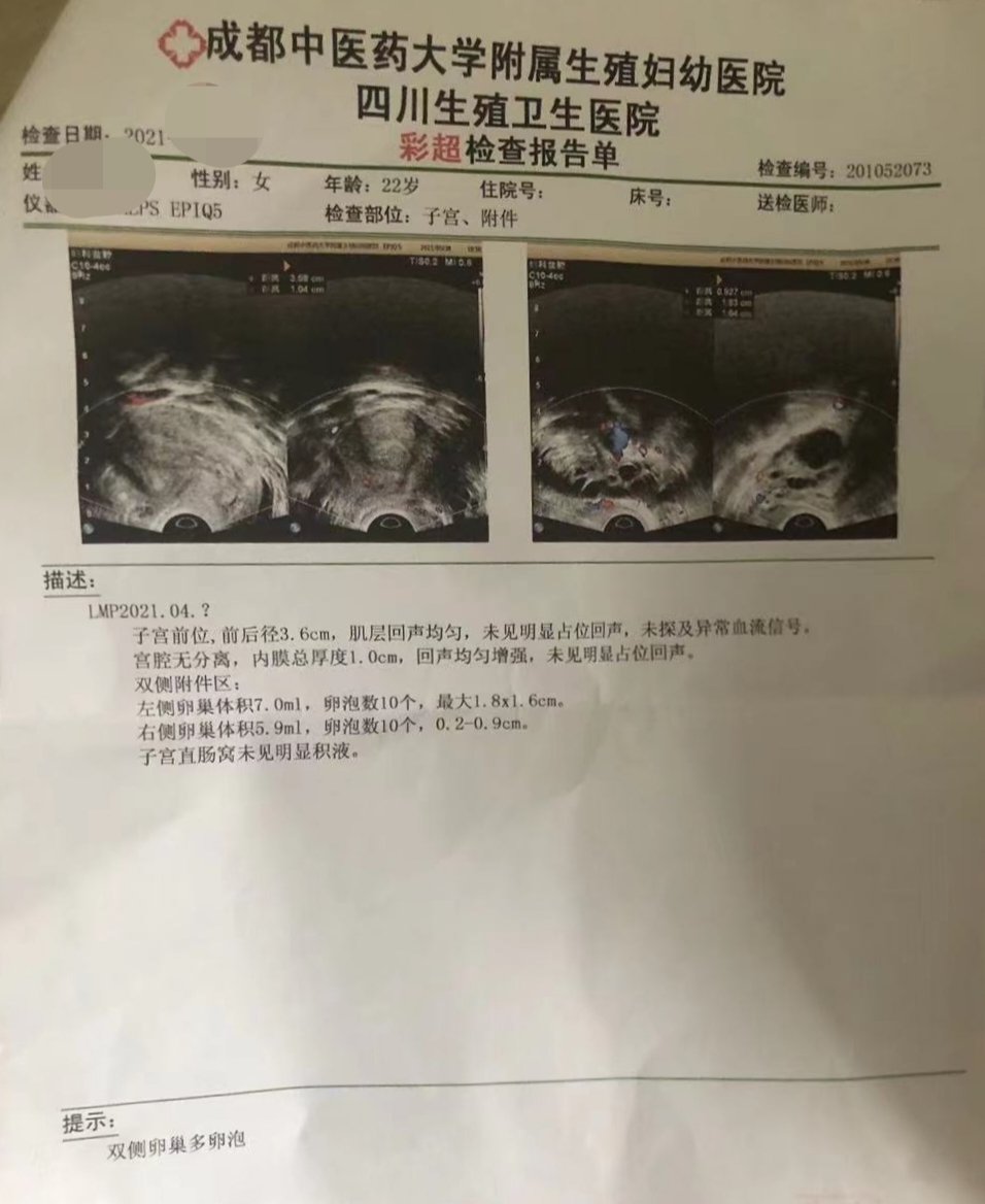 在询问性生活史后,我让女孩立即去查一个子宫附件阴超和女性激素6项.