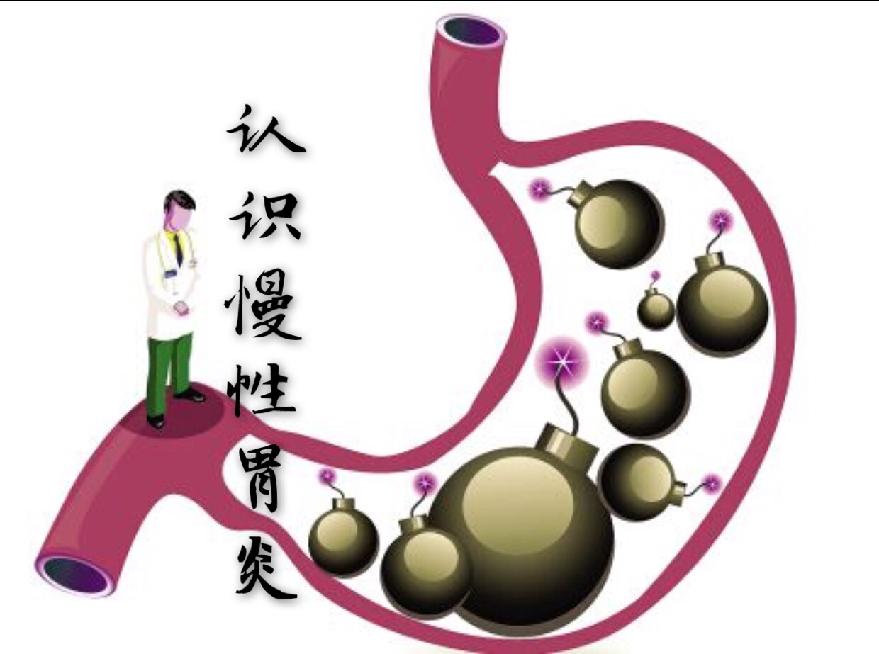 胃病系列科普之八——认识慢性胃炎