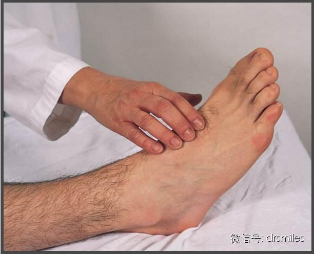 下肢动脉闭塞的早期信号间歇性跛行