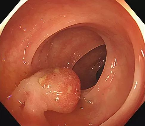管晓勇-爱问医生