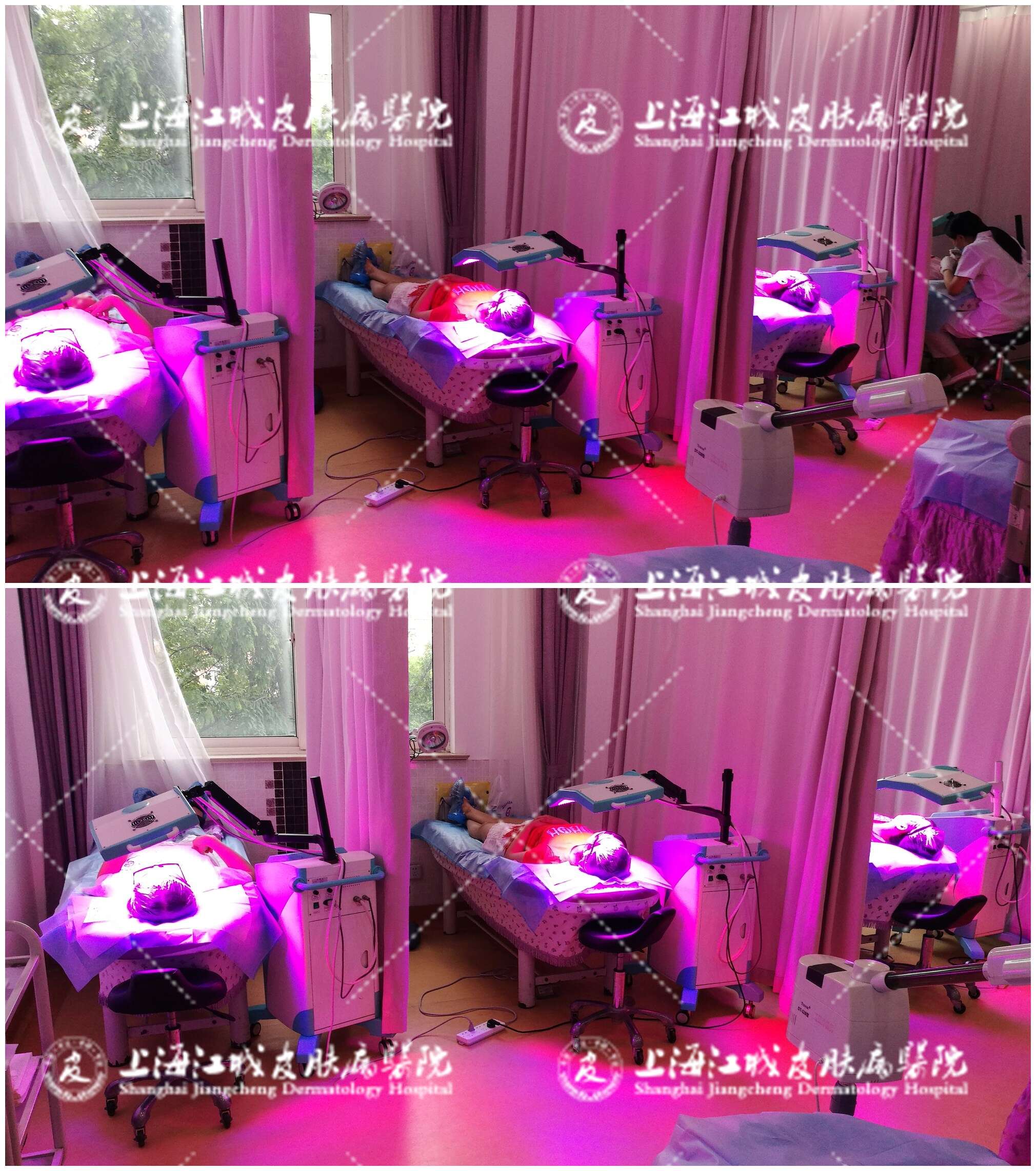 青春痘治疗区红红火火