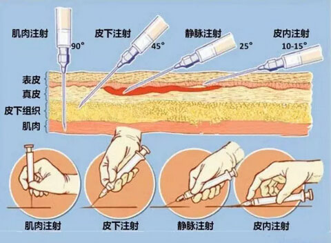 嗨体熊猫针注射层次图片