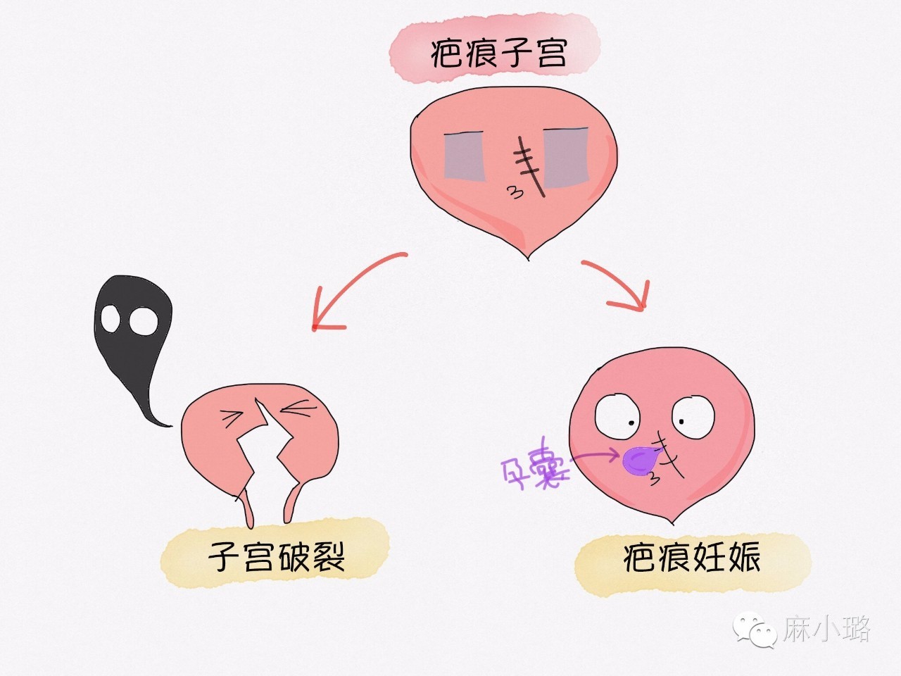二胎,想说生你不容易!