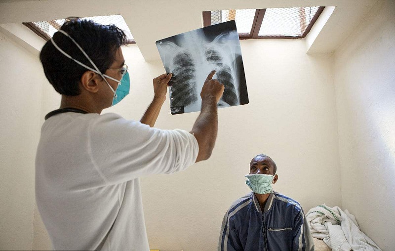 肺结核到底有多恐怖,即使完全消灭结核菌,也不能治回完好的肺