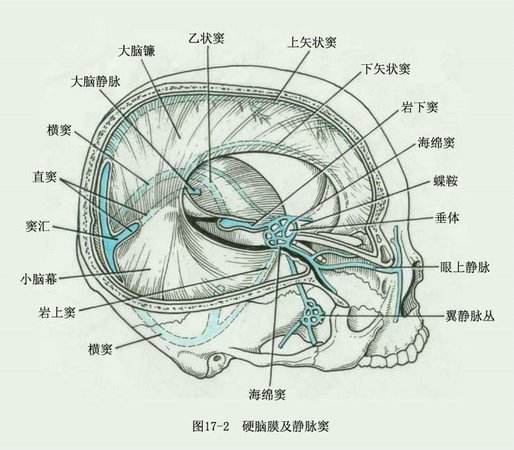 良性颅高压综合征与静脉窦狭窄