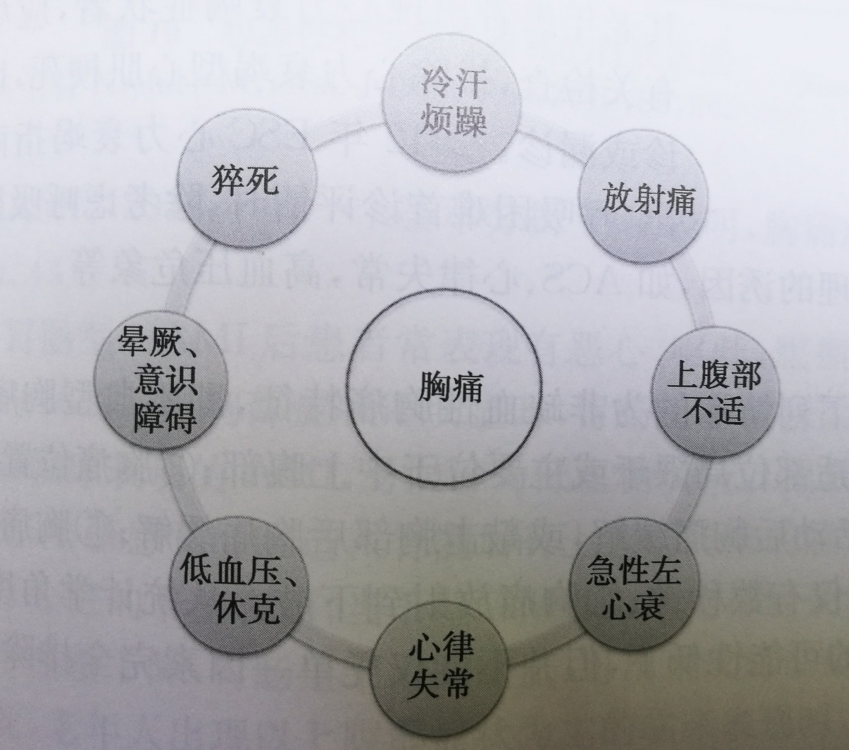急性心肌梗死不典型症状汇总