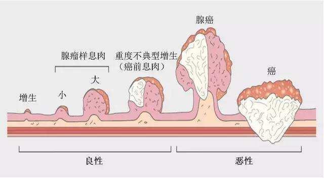 (4)家族性腺瘤性息肉病或者林奇綜合徵的家族人員