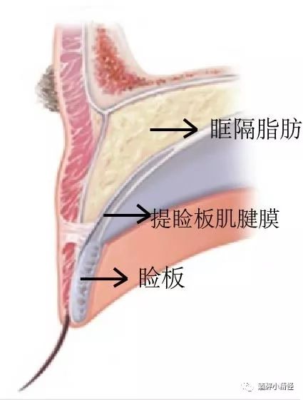 眼轮匝肌和提肌腱膜分支有一个连接点,它会牵拉着眼睑的皮肤向上折叠