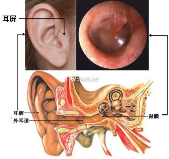 外耳门位置图片