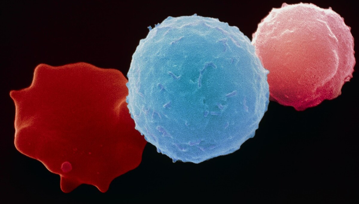 化疗后常见白细胞降低,有人说打升白针可能诱发白血病,该怎么办-胡洋