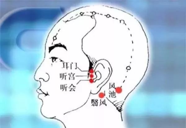 手法可以採用瀉法,虛證用補法,毫針刺(家庭治療可用梅花針釦刺法或