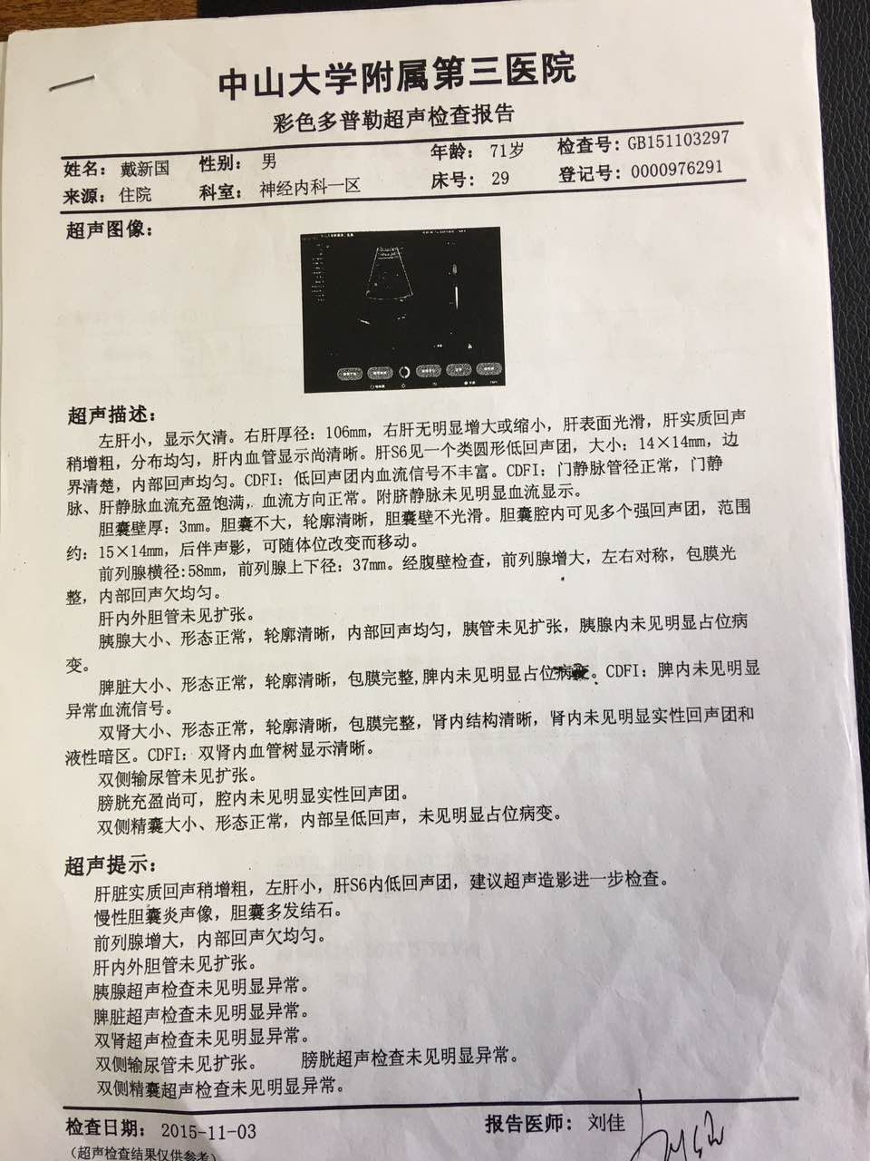 身患肝癌并伴有脑梗,心梗,治疗十个月创造生命奇迹!