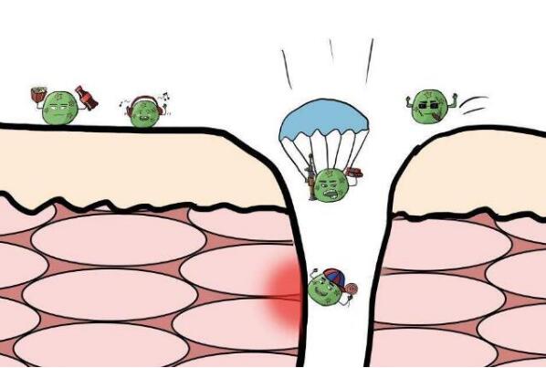 妇科疣病要怎么治疗