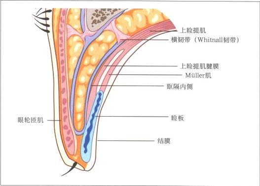 上睑外翻(退缩)