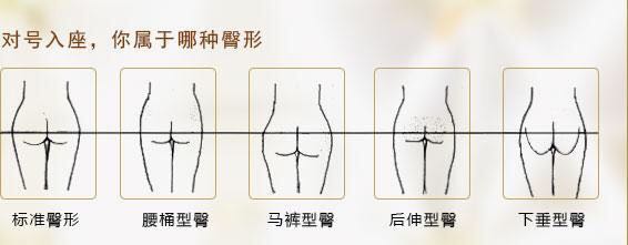 90后伸型:臀部脂肪集中在臀裂两端,臀部向后伸展.