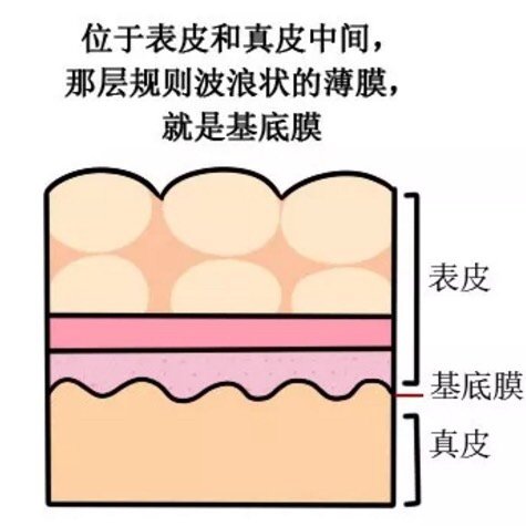 敏感肌是因为多种原因导致基底膜受损,基底膜是位于真皮层和表皮层