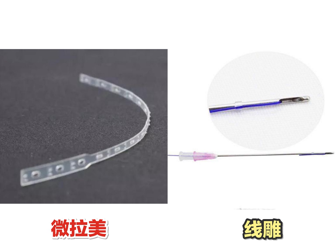 【原创】微拉美和线雕的区别在哪里?