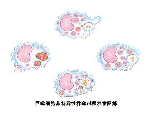 这其中的关键点在于巨噬细胞能够产生炎症因子,也就是说随着肥胖程度