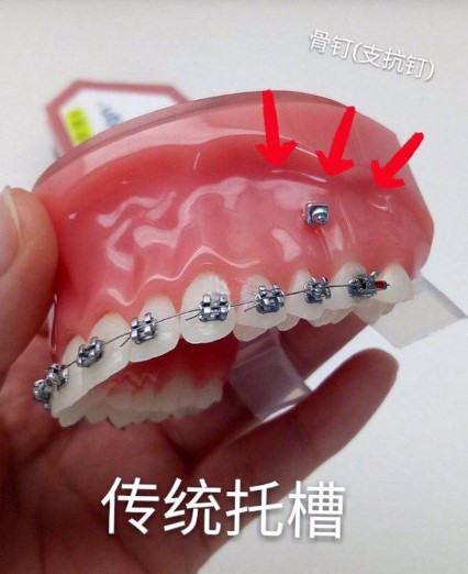 金属矫正 钢丝知识干货整理