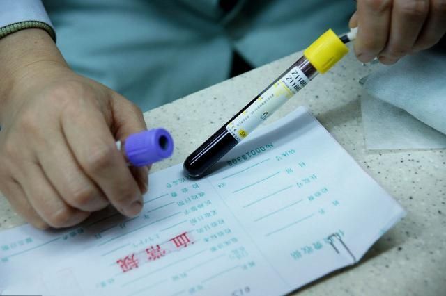 这几类人群要定期检查血脂四项,如发现异常一定正规控制,但不管血脂