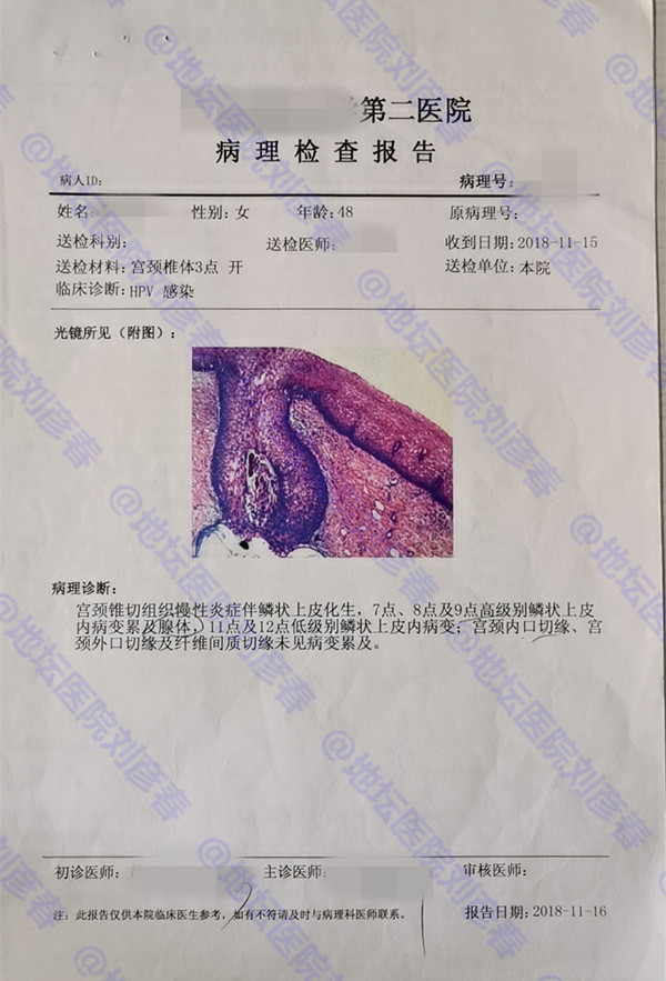 宫颈锥切术病理报告图片