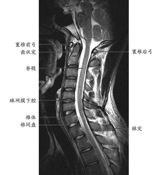 核磁x光ct受伤之后我该拍哪个片子