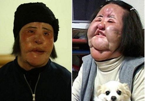 往脸上注射食用油的"电风扇大妈"走了,她也曾美过王祖贤