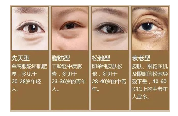 不过,上面说的这几种眼袋的类型都是有方法在一定程度上进行改善的
