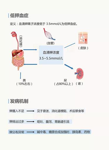 钾低是什么原因引起的图片