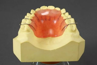 牙齿矫正过程中会遇到的专业名词,基本上就是以上七种了.