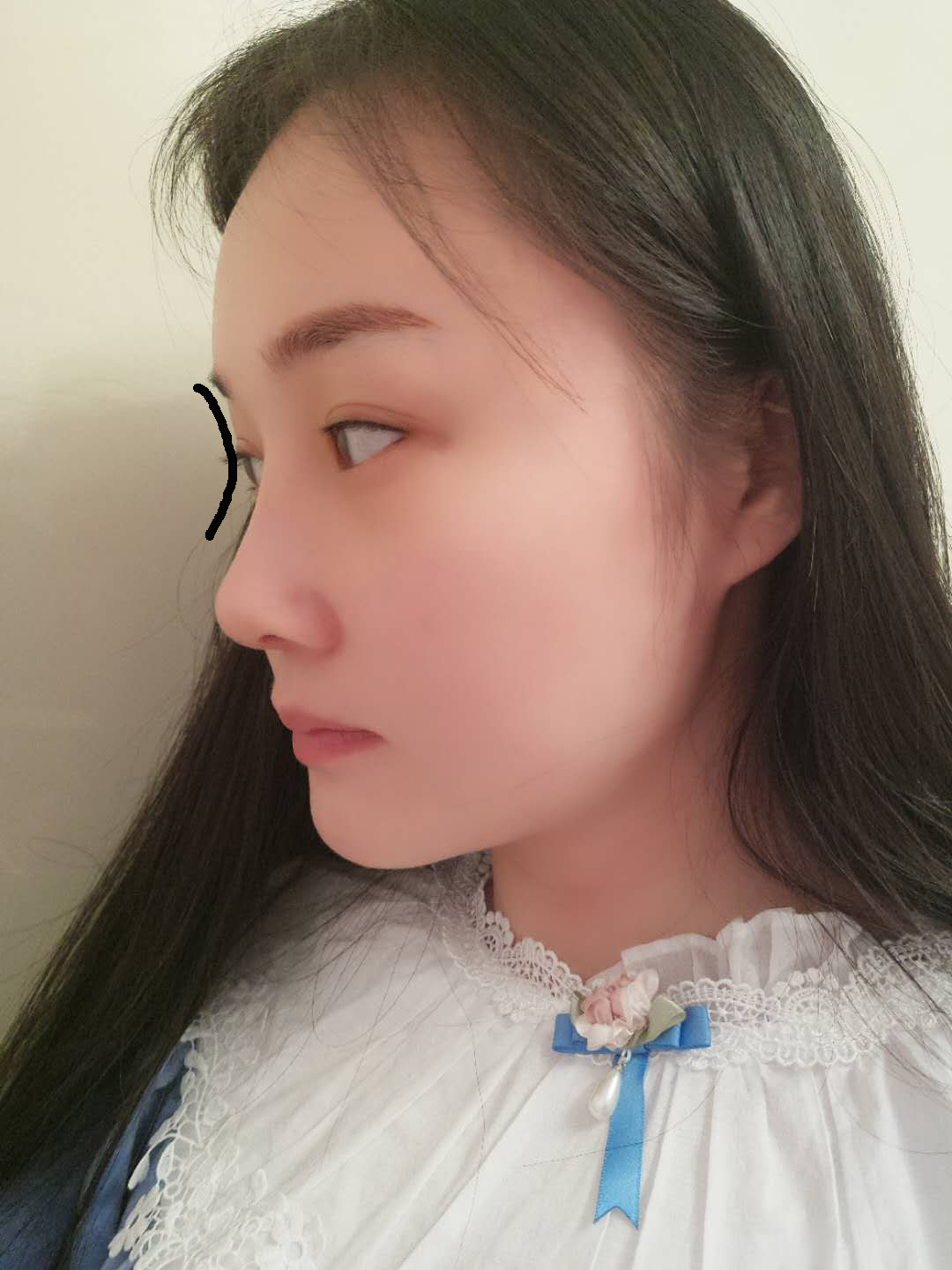 好看的鼻子由4个关键美学角度鼻额角