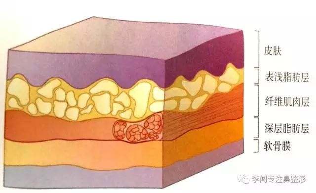 2,鼻部软组织张力处理