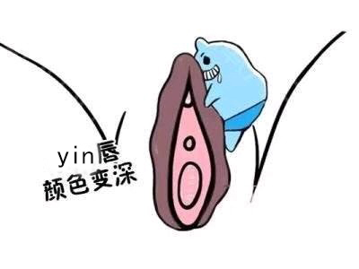 女生下面变黑了,是什么原因?