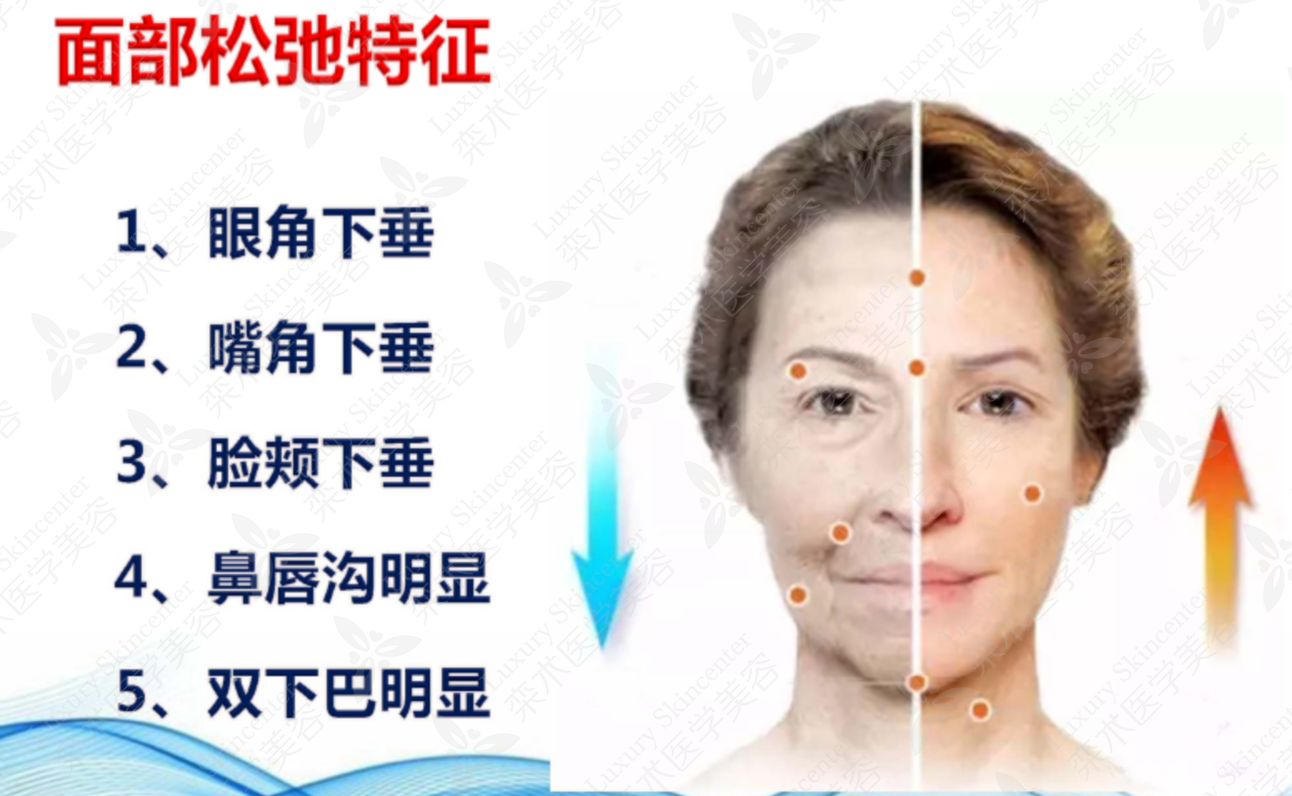 面部的法令纹和鼻基底凹陷有什么区别吗？ - 知乎