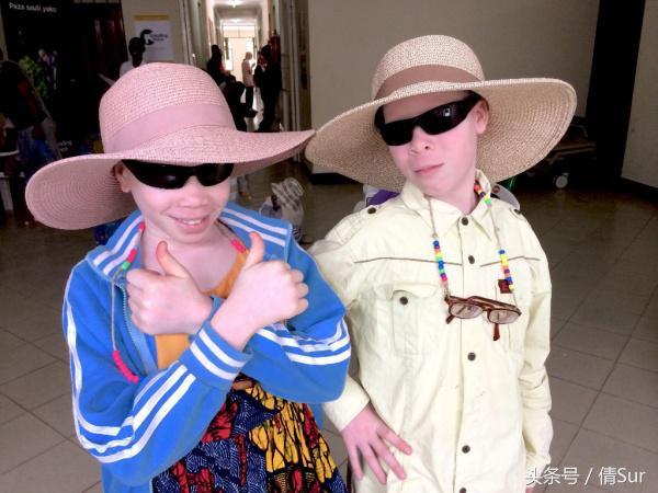 白化病患者来自月亮的孩子