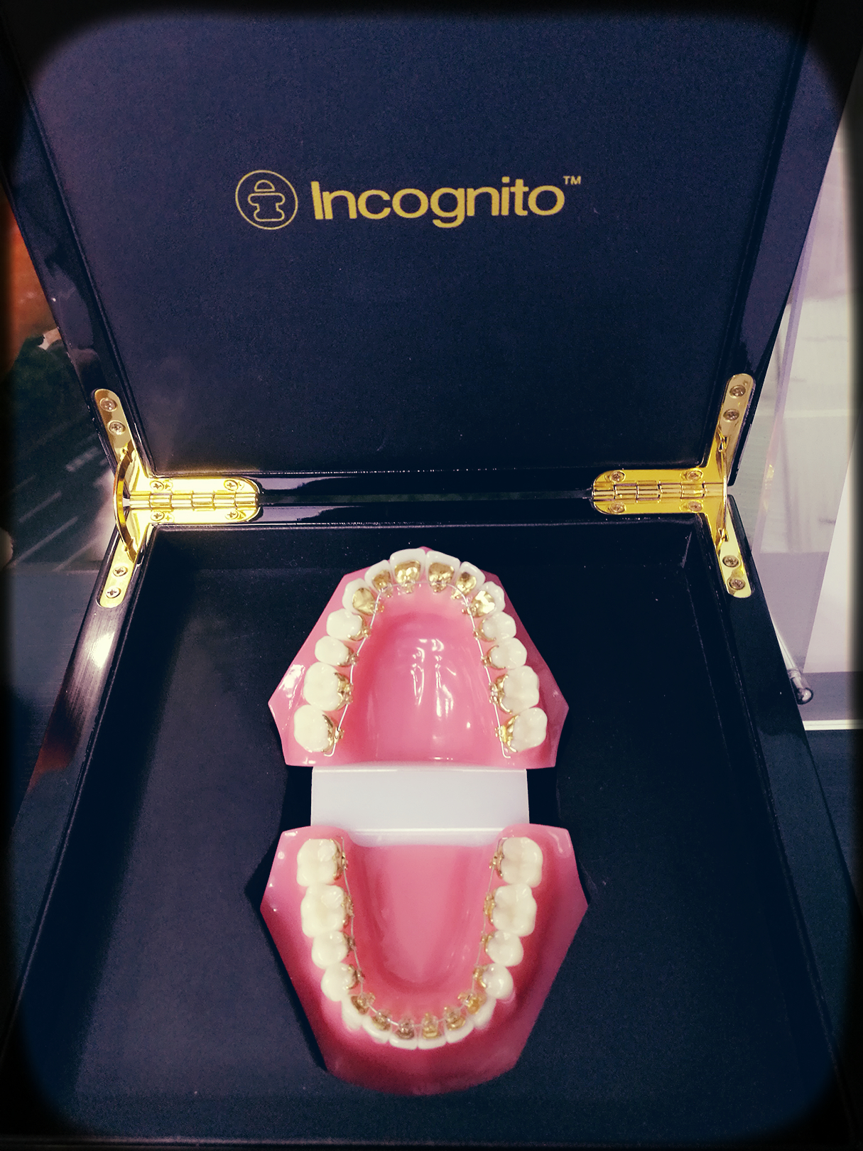 梁爱燕医生:incognito舌侧托槽粘结