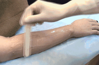 冰点脱毛的季节现在就刚刚好