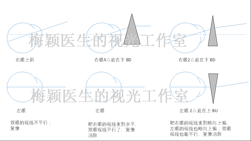 压贴三棱镜的应用简介