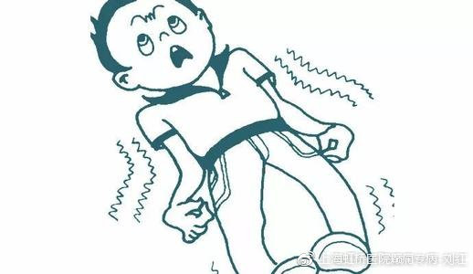 只有抽搐才是癫痫这些癫痫症状你一定要知道