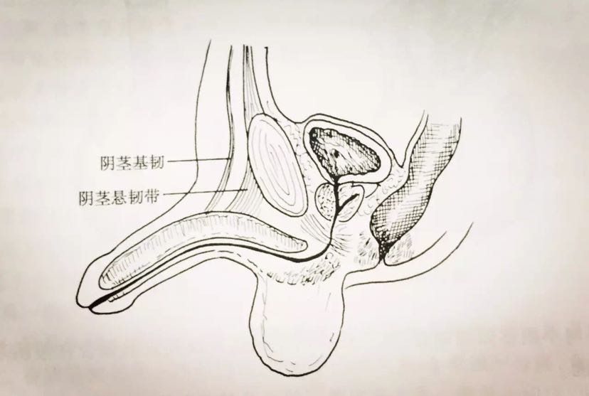 丁丁延长术图片