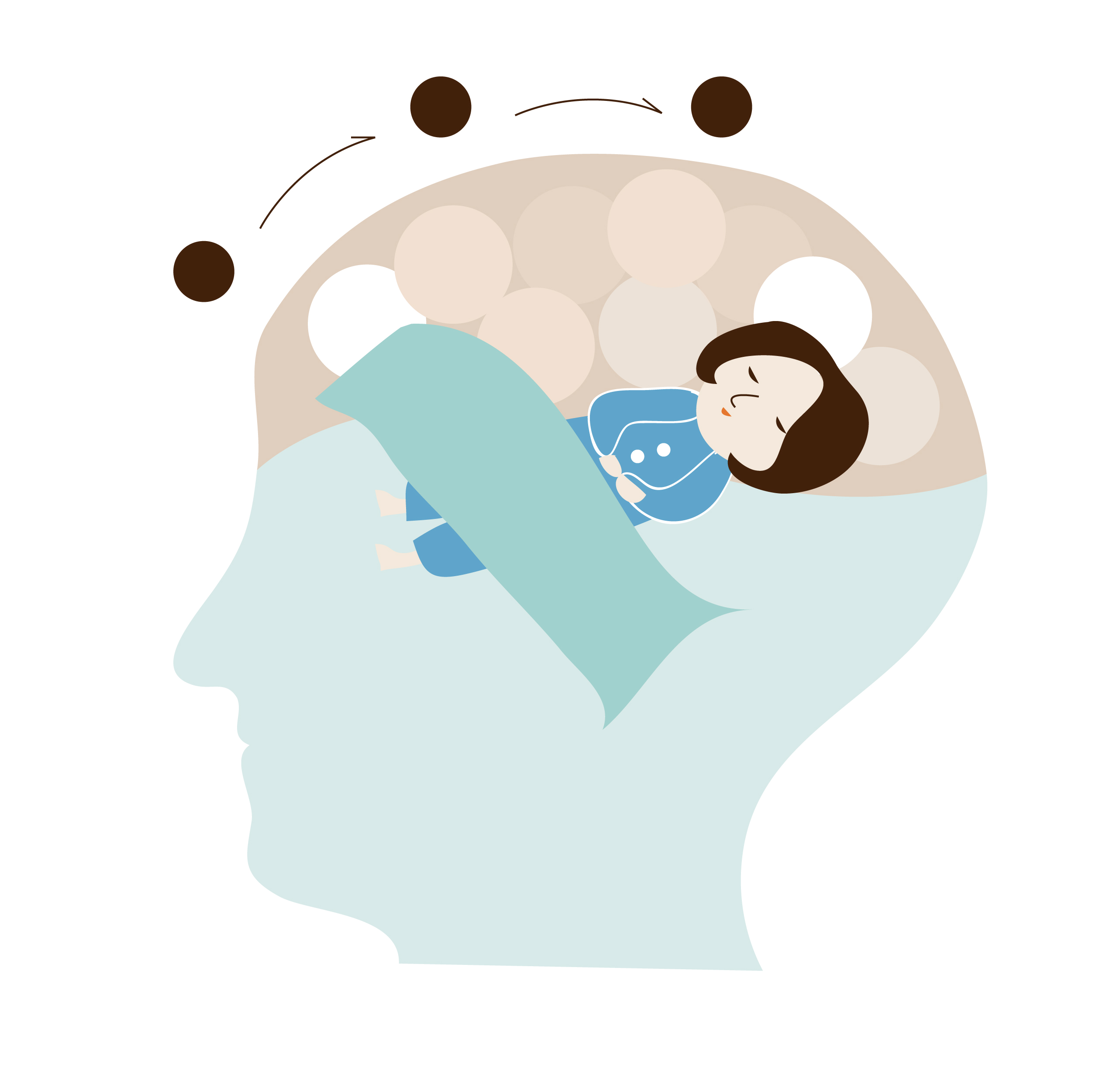 睡着了癫痫发作是怎么回事