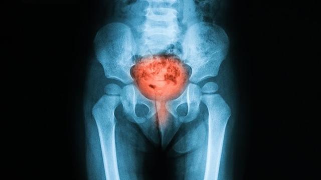 男同胞注意了：长期久坐容易影响泌尿系统健康