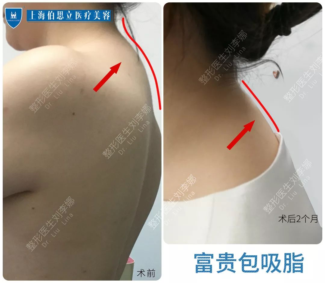 仙女体雕 每个女人心中都藏着一个维密天使