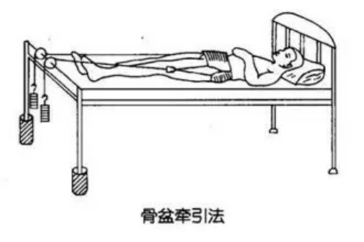 腰间盘突出牵引示范图图片