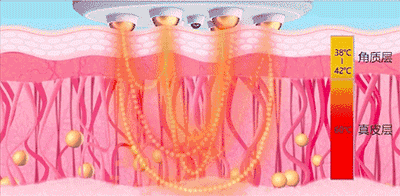 皮肤屏障受损应该如何选择护肤品