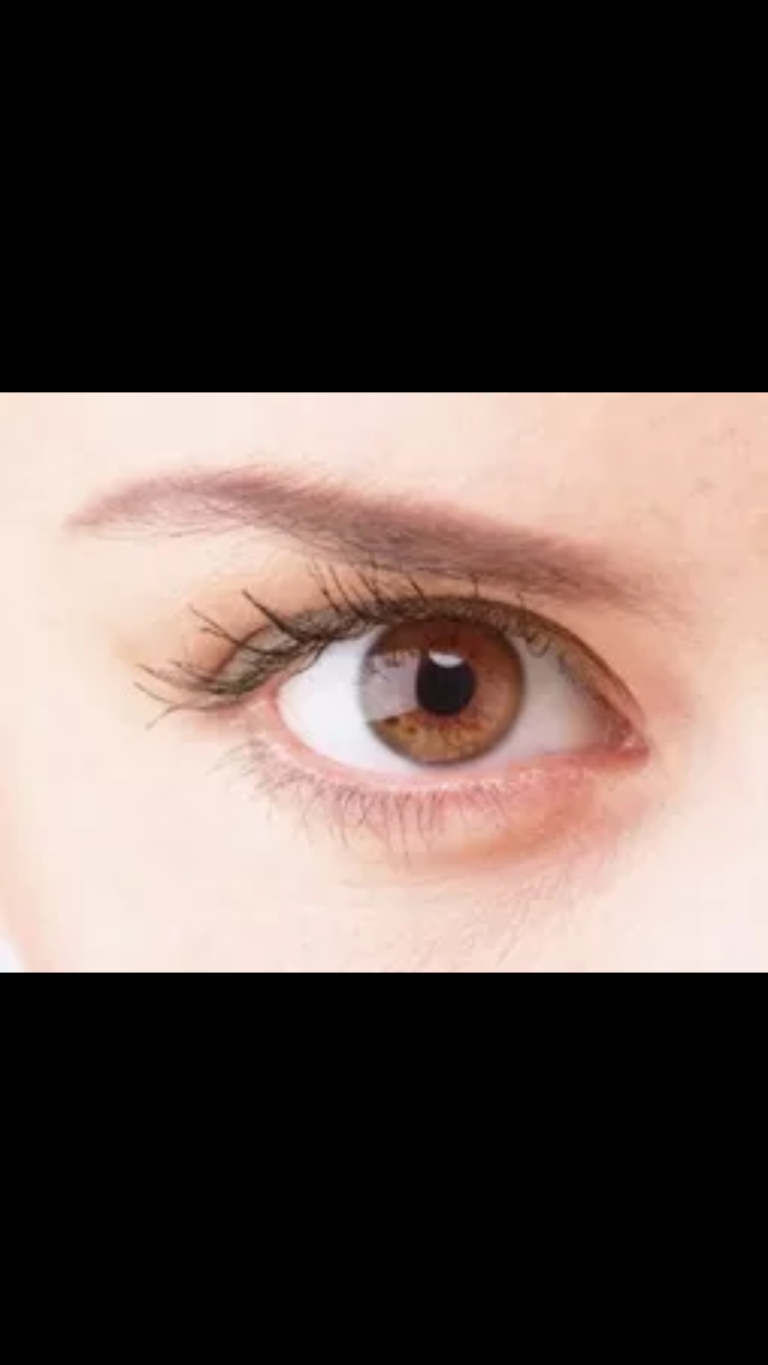 人的瞳孔放大,正常瞳孔和瞳孔放大图_大山谷图库