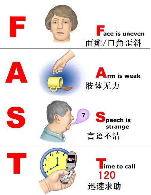 快速识别脑卒中"fast!