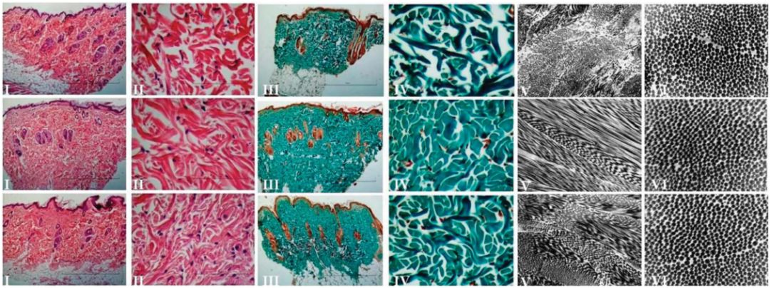 plla童颜线vspdo线在面部年轻化中谁更线一步