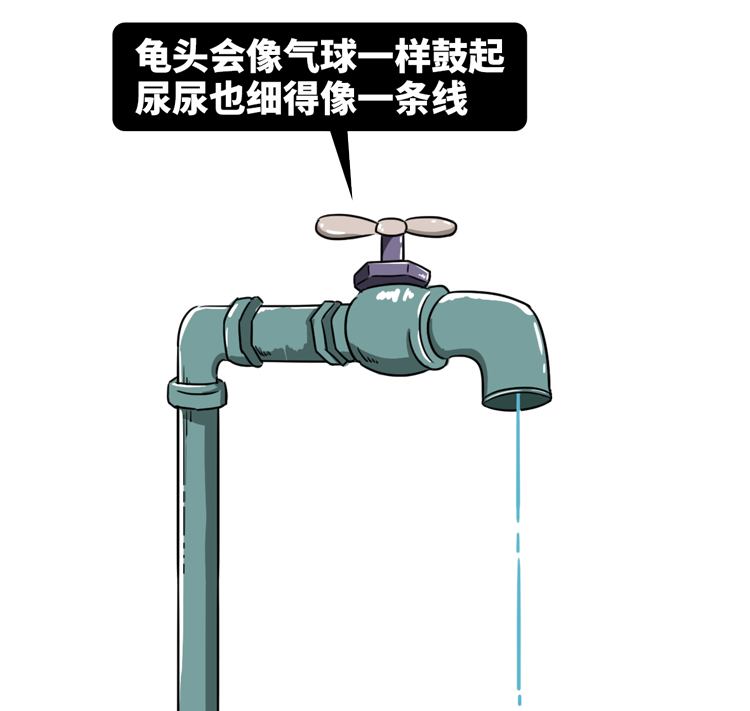 白色"奶酪"你的阴茎包皮,龟头会潮红出现这种炎症通常来说包皮龟头炎